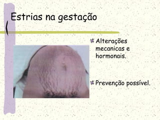 Estrias na gestação
Alterações
mecanicas e
hormonais.
Prevenção possível.
 