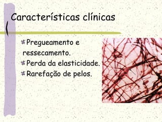 Características clínicas
Pregueamento e
ressecamento.
Perda da elasticidade.
Rarefação de pelos.
 