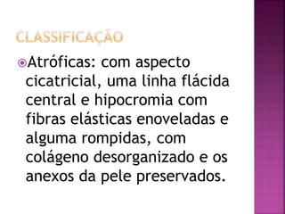 Atróficas: com aspecto
cicatricial, uma linha flácida
central e hipocromia com
fibras elásticas enoveladas e
alguma rompidas, com
colágeno desorganizado e os
anexos da pele preservados.
 