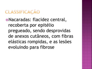 Nacaradas: flacidez central,
recoberta por epitélio
pregueado, sendo desprovidas
de anexos cutâneos, com fibras
elásticas rompidas, e as lesões
evoluindo para fibrose
 