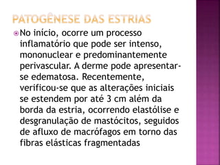 No início, ocorre um processo
inflamatório que pode ser intenso,
mononuclear e predominantemente
perivascular. A derme pode apresentar-
se edematosa. Recentemente,
verificou-se que as alterações iniciais
se estendem por até 3 cm além da
borda da estria, ocorrendo elastólise e
desgranulação de mastócitos, seguidos
de afluxo de macrófagos em torno das
fibras elásticas fragmentadas
 