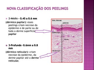  2-Médio - 0.45 a 0.6 mm
(dérmico papilar): esses
peelings criam necrose da
epiderme e de parte ou de
toda a derme superficial ou
papilar
 3-Profundo -0.6mm a 0.8
mm
(dérmico reticular): criam
necrose da epiderme, da
derme papilar até a derme
reticular.
 
