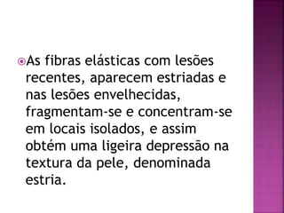As fibras elásticas com lesões
recentes, aparecem estriadas e
nas lesões envelhecidas,
fragmentam-se e concentram-se
em locais isolados, e assim
obtém uma ligeira depressão na
textura da pele, denominada
estria.
 
