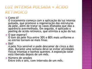  Como é?
O tratamento começa com a aplicação da luz intensa
pulsada, que promove a regeneração das estruturas
da pele, além de tratar os vasos dilatados que dão a
aparência avermelhada. Em seguida, é aplicado o
peeling de ácido retinoico, que otimiza a ação da luz.
 O que esperar?
O tom da pele fica entre 30% e 80% mais uniforme e
as estrias tornam-se mais finas.
 Dói?
A pele fica sensível e pode descamar de cinco a dez
dias. Durante uma semana deve-se evitar atividades
físicas intensas e banhos quentes. A exposição solar
está liberada depois de um mês.
 Número de sessões
Entre três e seis, com intervalo de um mês.
 