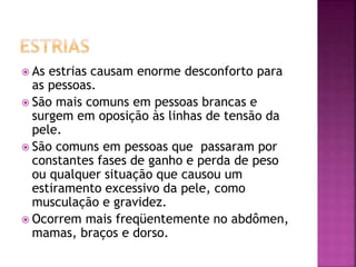  As estrias causam enorme desconforto para
as pessoas.
 São mais comuns em pessoas brancas e
surgem em oposição às linhas de tensão da
pele.
 São comuns em pessoas que passaram por
constantes fases de ganho e perda de peso
ou qualquer situação que causou um
estiramento excessivo da pele, como
musculação e gravidez.
 Ocorrem mais freqüentemente no abdômen,
mamas, braços e dorso.
 
