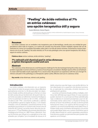 18	 Dermatología Venezolana. Vol. 45, Nº 1, 2007
Artículo
Introducción
Las estrías cutáneas o de distensión son un trastorno
muy común en todos los grupos etarios, desarrollándose
generalmente entre los 5 y 50 años de edad. Son depre-
siones lineales atróficas de la piel que se forman en áreas
de daño producido por la distensión de la piel. Están ma-
yormente asociadas con diferentes momentos fisiológicos
como la pubertad (incidencia del 25-35%)1
, embarazo
(incidencia del 77%)2
, crecimiento acelerado y además
con la pérdida o ganancia rápida de peso, o con estados
mórbidos como la obesidad y característicamente en las
patologías que producen un aumento del cortisol como el
síndrome de Cushing. Las estrías fueron descritas por pri-
mera vez en 1773 por Roederer y las primeras descripciones
histológicas las hicieron en 1889 Troisier y Menetrier. Pero
aun los factores que influyen en su patogenia no han sido
aclarados por completo. Son el resultado de roturas en el
tejido conjuntivo que dan lugar a una atrofia dérmica. Se
han relacionado con su aparición a los factores hormona-
les, en particular los corticoides, el estrés mecánico y la
predisposición genética.
Las estrías son lesiones lineales atróficas múltiples, simé-
tricas, bien definidas que siguen líneas. En raras ocasiones
pueden ulcerarse. En un principio son líneas sobreelevadas
rojas o violáceas en ocasiones pruriginosas y que son de-
nominadas estrías rubras (Foto 1). Al pasar el tiempo, las
lesiones se hacen más atróficas y el color va disminuyendo
hasta hacerse claras y con aspecto de finas arrugas en su
superficie, son entonces las llamadas estrías albas (Foto 2).
Pueden medir varios centímetros de longitud y con anchos
que pueden llegar hasta unos cuantos centímetros que es
el valor determinante en cuanto a gravedad y pronóstico.
Estas lesiones pueden ser permanentes pero pueden des-
aparecer con el tiempo1
.
“Peeling” de ácido retinóico al 7%
en estrías cutáneas:
una opción terapéutica útil y segura
Susana Misticone, Vanesa Piquero
	 	 Consulta de Acné y Afecciones Inestéticas, Instituto de Biomedicina, Hospital Vargas de Caracas. Caracas, Venezuela.
	 	 E-mail: susanamisticone@gmail.com
Resumen
Las estrías cutáneas son un verdadero reto terapéutico para el dermatólogo, siendo esta una entidad de gran
prevalencia sobre todo en mujeres y un motivo de consulta muy frecuente. Existen múltiples reportes del uso de
tretinoína en crema con resultados favorables sobre todo si se trata de estrías recientes. Presentamos nuestra expe-
riencia con el uso de “peeling” de ácido retinóico al 7% en esta patología como una opción terapéutica útil, eficaz y
segura en estrías cutáneas.
Palabras clave: estrías cutáneas, ácido retinóico, “peeling”.
7% retinoid acid chemical peel in striae distensae:
a option therapeutic useful and sure
Abstract
The cutaneous striae distensae are a real therapeutic challenge for the dermatologist being this entity very comun
problemespeciallyinwomenandthatisamotiveofveryfrequentconsultation.Multiplereportsoftheuseoftretinoin
in cream with favorable results especially if it is a recent striae. We present our experience with the use of of gel 7%
retinoic acid peel in this pathology as a therapeutic option useful, effective and sure in cutaneous striae.
Key words: striae distensae, retinoic acid, peeling.
 