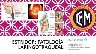 ESTRIDOR: PATOLOGÍA
LARINGOTRAQUEAL
PRESENTADO POR:
Int. Medicina Dagiana Nahomi
Reyna Quiñones
ROTE DE PEDIATRÍA
 