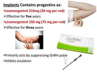Implants Contains progestins as:
•Levonorgestrel 216mg (36 mg per rod)
Effective for five years
•Levonorgestrel 150 mg (75 mg per rod)
Effective for three years
•Primarily acts by suppressing GnRH pulse
•Inhibits ovulation
 