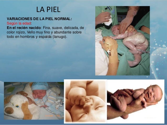 Como blanquear la piel de las pecas y la pigmentación rápidamente