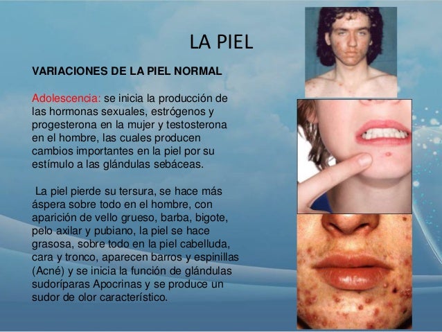 Las uñas desigual a la psoriasis