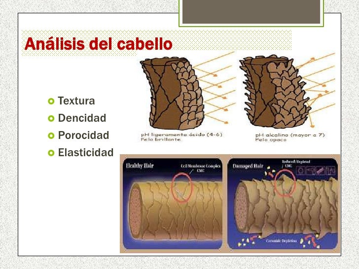 pediculosis capitis