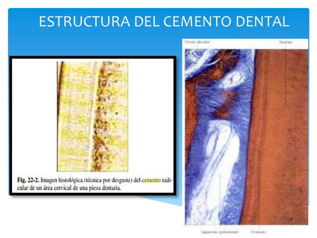 Estructura Cemento dental