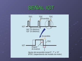 SEÑAL IGTSEÑAL IGT