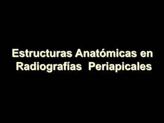 Estructuras Anatómicas en
Radiografías Periapicales
 