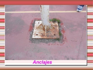 Anclajes
 