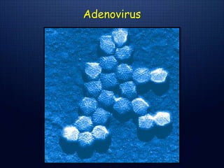 Adenovirus
 