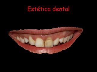 Estética dental
 