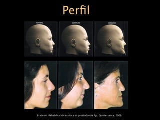 Perﬁl




Fradeani. Rehabilitación estética en prostodoncia ﬁja. Quintessence. 2006.
 