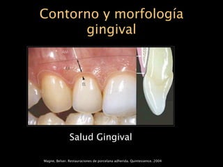 Contorno y morfología
      gingival




               Salud Gingival

Magne, Belser. Restauraciones de porcelana adherida. Quintessence. 2004
 