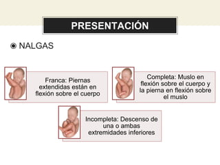 PRESENTACIÓN
◉ NALGAS
Franca: Piernas
extendidas están en
flexión sobre el cuerpo
Completa: Muslo en
flexión sobre el cuerpo y
la pierna en flexión sobre
el muslo
Incompleta: Descenso de
una o ambas
extremidades inferiores
 
