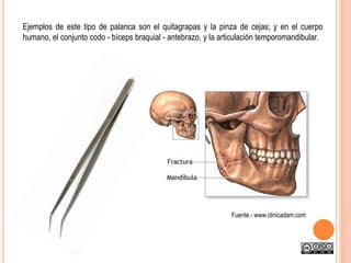 Ejemplos de este tipo de palanca son el quitagrapas y la pinza de cejas; y en el cuerpo
humano, el conjunto codo - bíceps braquial - antebrazo, y la articulación temporomandibular.
Fuente.- www.clinicadam.com
 