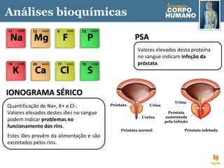 Valores elevados desta proteína
no sangue indicam infeção da
próstata.
PSAPSA
Quantificação de Na+, K+ e Cl-.
Valores elevados destes iões no sangue
podem indicar problemas no
funcionamento dos rins.
Estes iões provêm da alimentação e são
excretados pelos rins.
IONOGRAMA SÉRICOIONOGRAMA SÉRICO
Análises bioquímicas
Próstata normal Próstata infetada
Urina
Urina
Próstata
Próstata
aumentada
pela infeção
Uretra
 