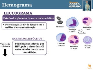 Estudo dos glóbulos brancos ou leucócitos.
EXEMPLO: LINFÓCITOS
Pode indicar infeção por
HIV, pois o vírus destrói
estas células do sistema
imunitário.
Hemograma
• Determinação do nº de leucócitos e
análise da sua morfologia.
LEUCOGRAMALEUCOGRAMA
Valores de
referência
Hemácias
Linfócito
14 a 45%
Monócito
3 a 10%
Eosinófilo
1 a 5%
Neutrófilo
45 a 75%
Basófilo
0 a 2%
Plaquetas
 