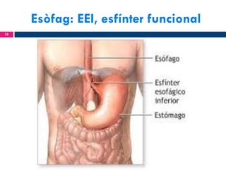 Esòfag: EEI, esfínter funcional
18

 