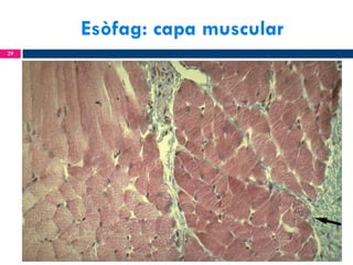 Esòfag: capa muscular
29

 