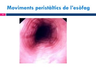 Moviments peristàltics de l’esòfag
35

 