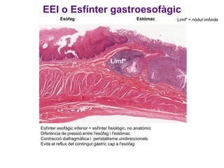 EEI o Esfínter gastroesofàgic
Esòfag

Estómac

Limf*

Esfínter esofàgic inferior = esfínter fisiològic, no anatòmic
Diferència de pressió entre l'esòfag i l'estómac
Contracció diafragmàtica i peristaltisme unidireccionals
Evita el reflux del contingut gàstric cap a l'esòfag

Limf* = nòdul imfoide

 