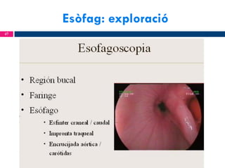 Esòfag: exploració
47

 