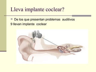 Lleva implante coclear?
 De los que presentan problemas auditivos
9 llevan implante coclear
 