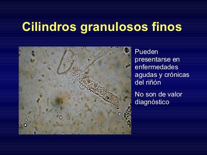 Estudio Renal