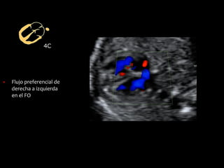 4C
▪ Flujo preferencial de
derecha a izquierda
en el FO
 