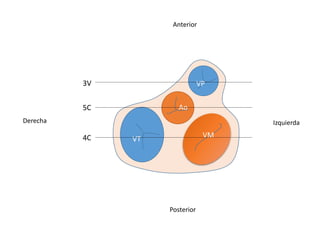 Derecha
Anterior
Posterior
Izquierda
VT VM
Ao
VP
4C
5C
3V
 