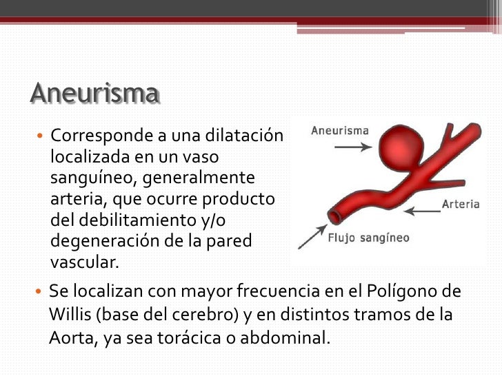 Estudio de aneurisma cerebral mediante angio tc