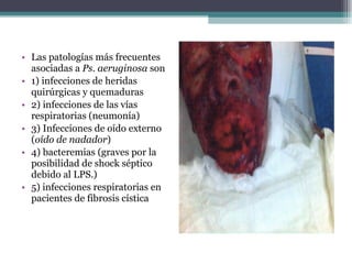 Las patologías más frecuentes asociadas a  Ps. aeruginosa  son 1) infecciones de heridas quirúrgicas y quemaduras 2) infecciones de las vías respiratorias (neumonía) 3) Infecciones de oído externo ( oído de nadador ) 4) bacteremias (graves por la posibilidad de shock séptico debido al LPS.) 5) infecciones respiratorias en pacientes de fibrosis cística 