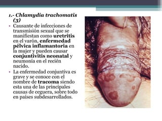 1 .- Chlamydia trachomatis (3) Causante de infecciones de transmisión sexual que se manifiestan como  uretritis  en el varón,  enfermedad pélvica inflamantoria  en la mujer y pueden causar  conjuntivitis   neonatal  y neumonía en el recién nacido. La enfermedad conjuntiva es grave y se conoce con el nombre de  tracoma  siendo esta una de las principales causas de ceguera, sobre todo en países subdesarrollados . 