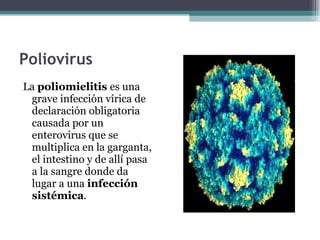 Poliovirus La  poliomielitis  es una grave infección vírica de declaración obligatoria causada por un enterovirus que se multiplica en la garganta, el intestino y de allí pasa a la sangre donde da lugar a una  infección sistémica . 