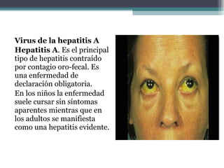 Virus de la hepatitis A Hepatitis A . Es el principal tipo de hepatitis contraído por contagio oro-fecal. Es una enfermedad de declaración obligatoria. En los niños la enfermedad suele cursar sin síntomas aparentes mientras que en los adultos se manifiesta como una hepatitis evidente.  