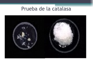 P rueba de la catalasa 
