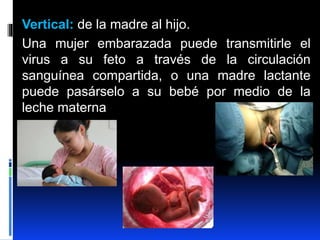 Vertical: de la madre al hijo.
Una mujer embarazada puede transmitirle el
virus a su feto a través de la circulación
sanguínea compartida, o una madre lactante
puede pasárselo a su bebé por medio de la
leche materna
 