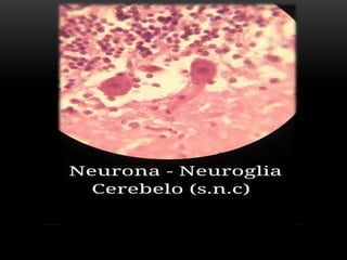 Estudio de imágenes de histologia