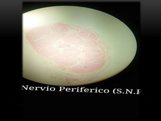 Estudio de imágenes de histologia