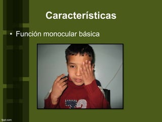 Características
• Función monocular básica
 