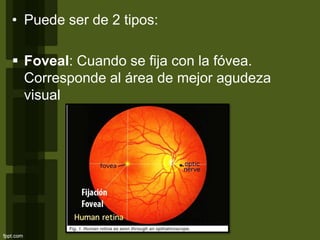 • Puede ser de 2 tipos:
 Foveal: Cuando se fija con la fóvea.
Corresponde al área de mejor agudeza
visual
 