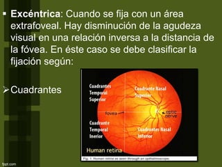  Excéntrica: Cuando se fija con un área
extrafoveal. Hay disminución de la agudeza
visual en una relación inversa a la distancia de
la fóvea. En éste caso se debe clasificar la
fijación según:
Cuadrantes
 