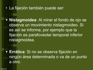 • La fijación también puede ser:
 Nistagmoidea: Al mirar el fondo de ojo se
observa un movimiento nistagmoideo. Si
es así se informa, por ejemplo que la
fijación es parafoveolar temporal inferior
nistagmoidea.
 Errática: Si no se observa fijación en
ningún área determinada o va de un punto
a otro.
 
