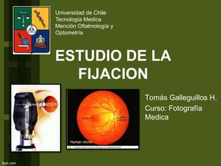ESTUDIO DE LA
FIJACION
Tomás Galleguillos H.
Curso: Fotografía
Medica
Universidad de Chile
Tecnología Medica
Mención Oftalmología y
Optometría
 